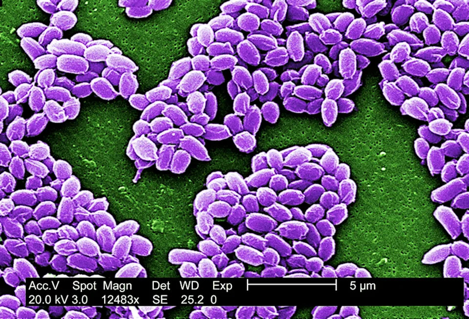 Spore-Forming Bacteria Are Exceptionally Tough — Their High Energy Cost Is the Weakness