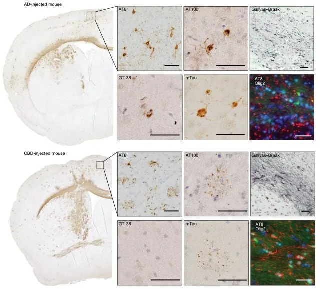 Human Alzheimer’s and CBD Tau Proteins Imprint Their Atomic Fold on Mouse Brains — Strong Evidence for Prion-Like Templating