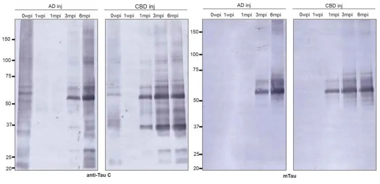Human Alzheimer’s and CBD Tau Proteins Imprint Their Atomic Fold on Mouse Brains — Strong Evidence for Prion-Like Templating