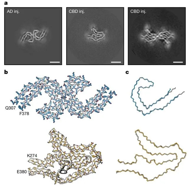 Human Alzheimer’s and CBD Tau Proteins Imprint Their Atomic Fold on Mouse Brains — Strong Evidence for Prion-Like Templating