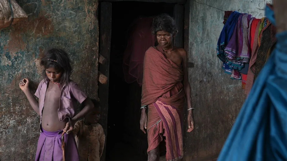 Children Dying in India’s Remote Tribal Heartland: Measles, Malaria, Malnutrition and Barriers to Care