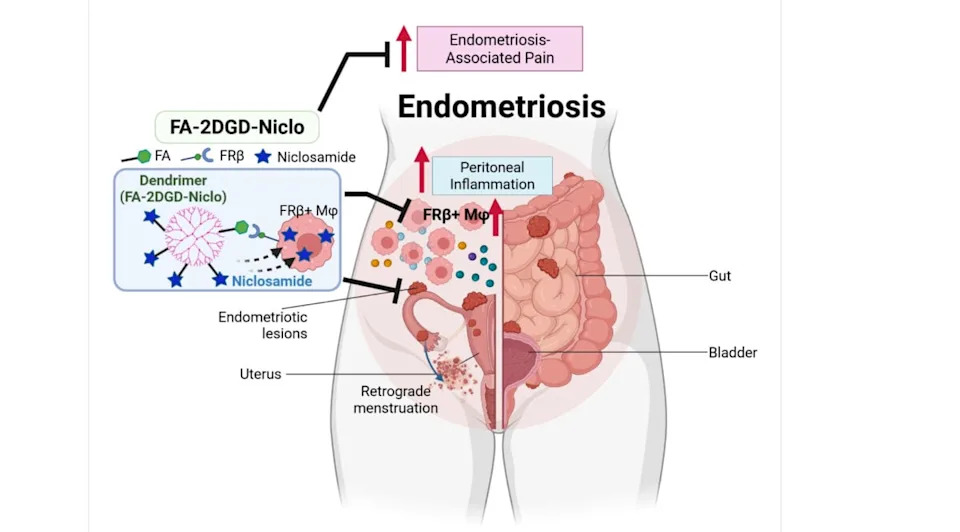 Tapeworm Drug Niclosamide, Carried by a Dendrimer, Reduces Endometriosis Lesions and Pain in Mice