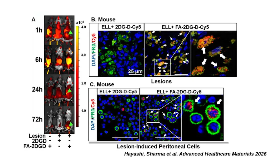 Tapeworm Drug Niclosamide, Carried by a Dendrimer, Reduces Endometriosis Lesions and Pain in Mice