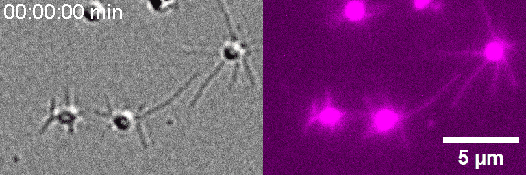 Live Footage Shows Asgard Archaea Crawling with Actin-Like Machinery — New Clues to the Origin of Complex Cells