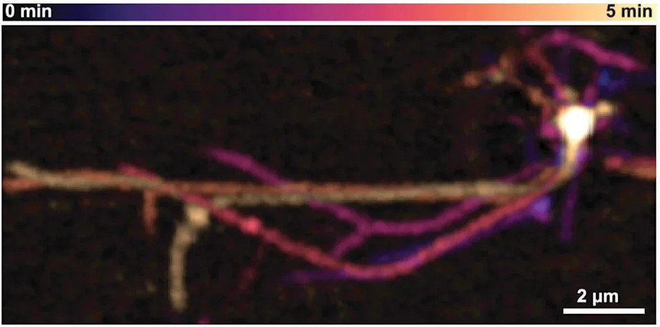 Live Footage Shows Asgard Archaea Crawling with Actin-Like Machinery — New Clues to the Origin of Complex Cells