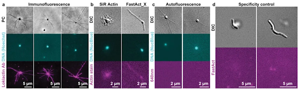 Live Footage Shows Asgard Archaea Crawling with Actin-Like Machinery — New Clues to the Origin of Complex Cells