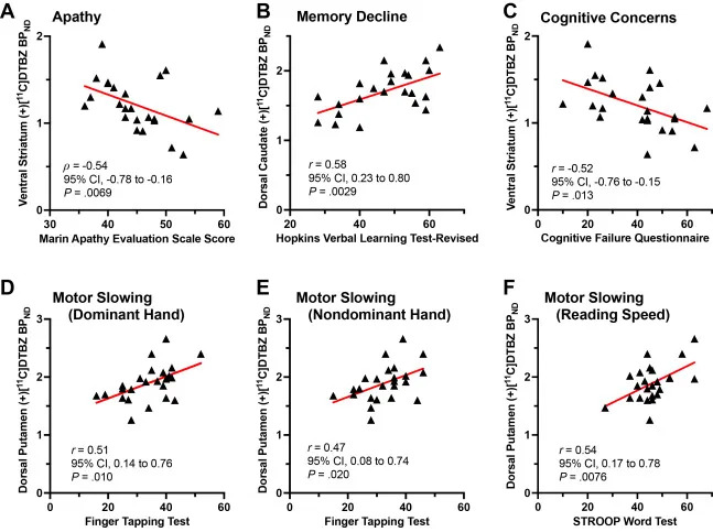 Brain Scans Suggest Dopamine Neuron Damage May Underlie Some Long COVID Symptoms