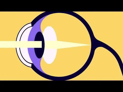 Single-Dose Gene Therapy Restores Vision and Rewires Adult Retinas in Dogs